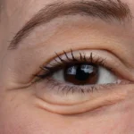 augenringe in 1 minute weg